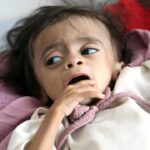 Birleşmiş Milletler'den Yemen İçin Kritik Uyarı: İnsani Kriz Derinleşiyor